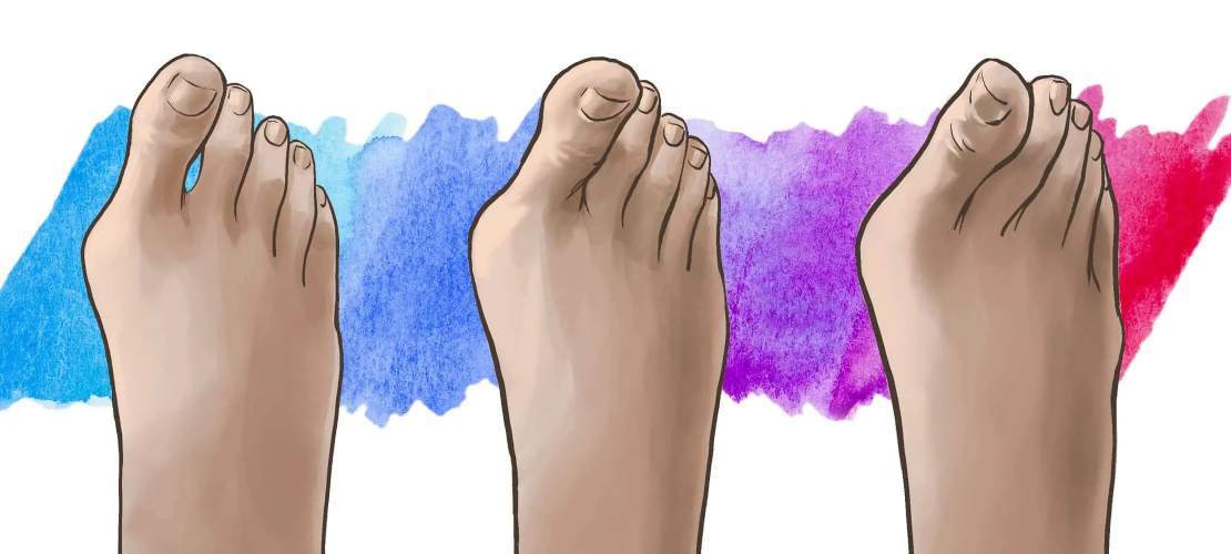 Three drawing of feet.