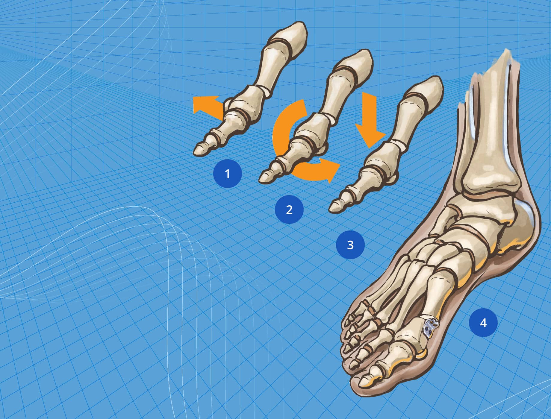 Foot keep movement diagram.